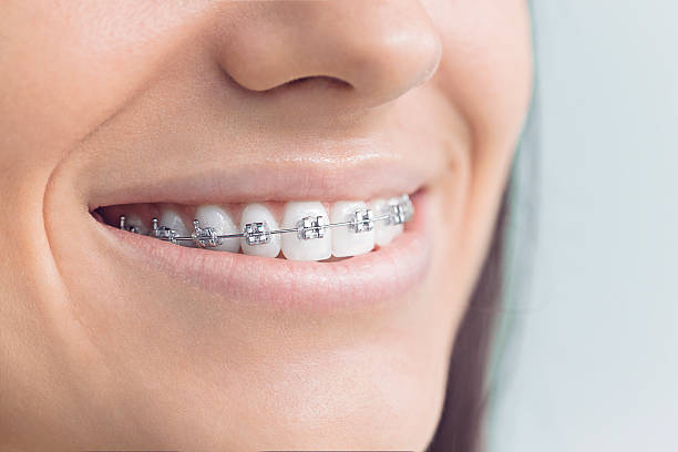 Best Invisalign and Clear Aligners  in Fort Thomas, KY